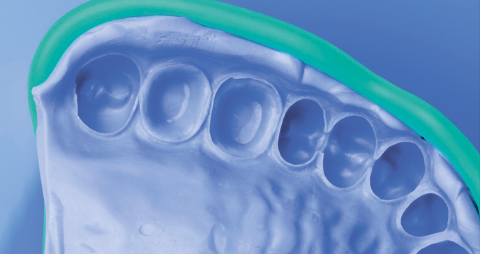 Силагум Патти Софт в слепочной ложке